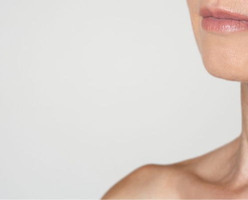 Rughe su collo e décolleté cosa fare